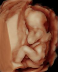 Baby Sadie Mae Harrison